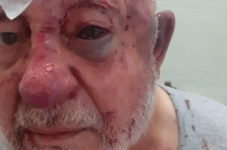 Konya'da 84 yaşındaki vakıf başkanına acımasız darp!